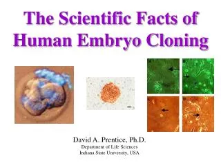 The Scientific Facts of Human Embryo Cloning