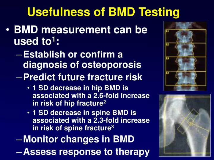 usefulness of bmd testing