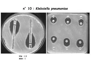n°10 : Klebsiella pneumoniae