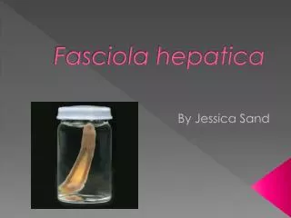 Fasciola hepatica