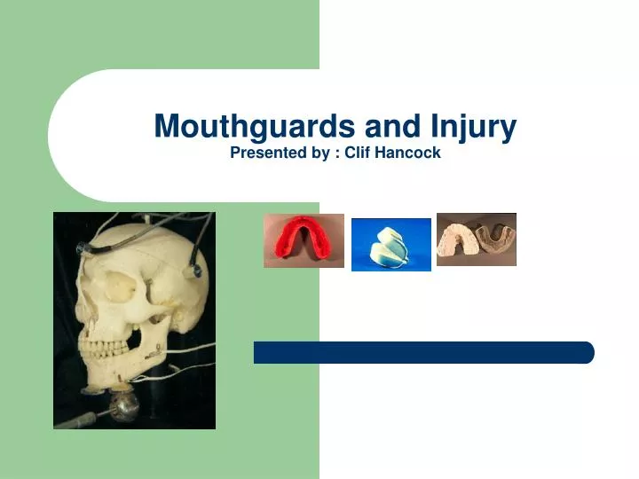 mouthguards and injury presented by clif hancock