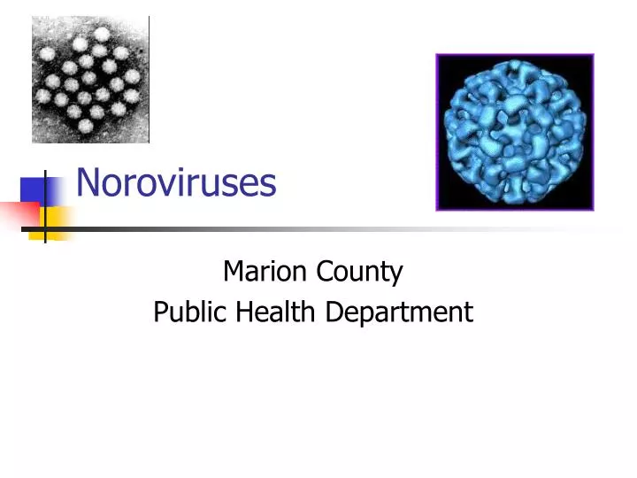 noroviruses