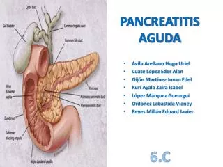 pancreatitis aguda