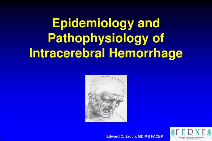 epidemiology and pathophysiology of intracerebral hemorrhage