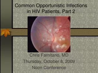 Common Opportunistic Infections in HIV Patients, Part 2