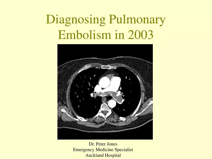 diagnosing pulmonary embolism in 2003