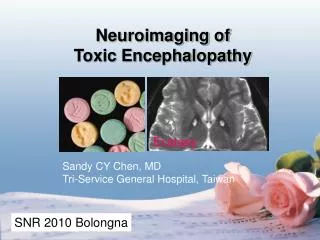 Neuroimaging of Toxic Encephalopathy
