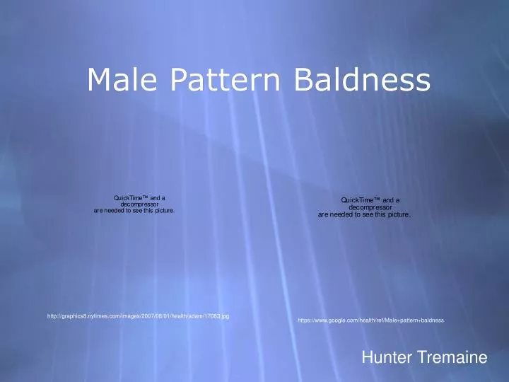 male pattern baldness