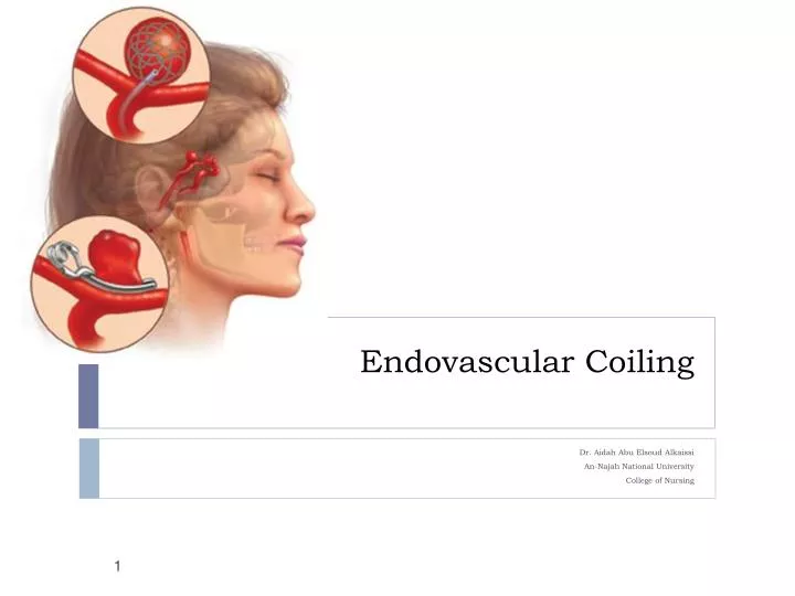 endovascular coiling