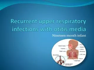 Recurrent upper respiratory infections with otitis media