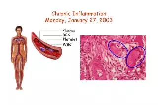 Chronic Inflammation Monday, January 27, 2003