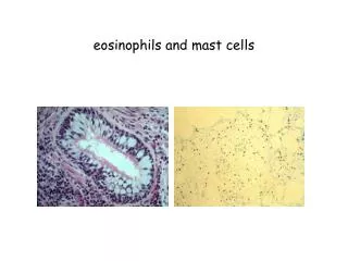 eosinophils and mast cells