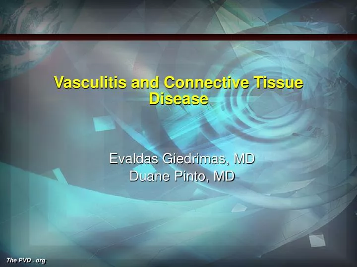 vasculitis and connective tissue disease
