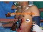 Abdominal trauma - slide 1