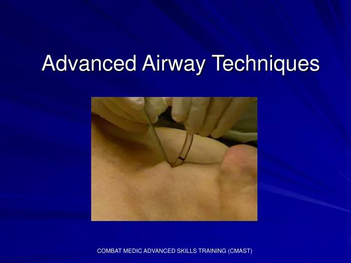advanced airway techniques