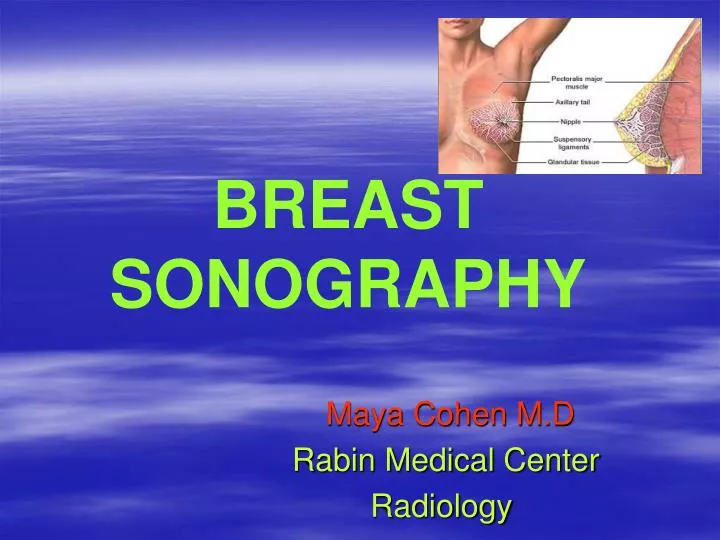 breast sonography