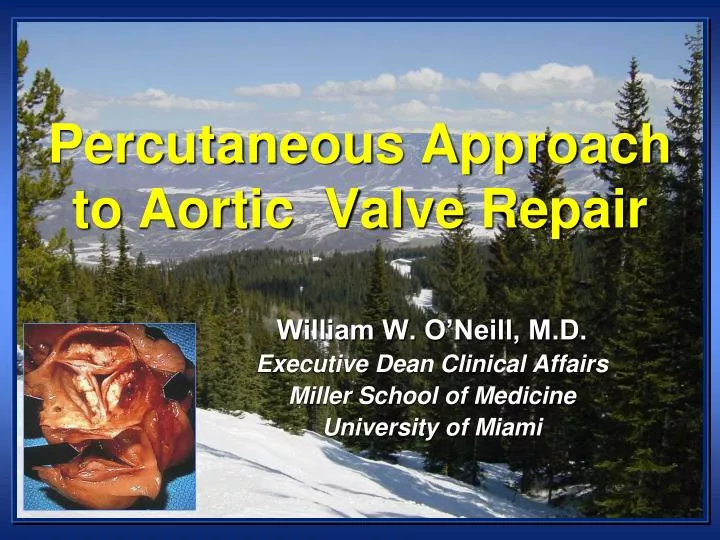 percutaneous approach to aortic valve repair