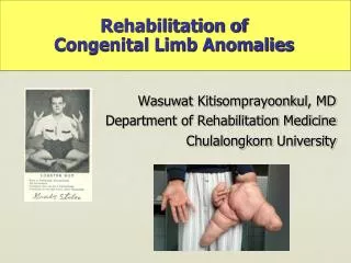 Rehabilitation of Congenital Limb Anomalies