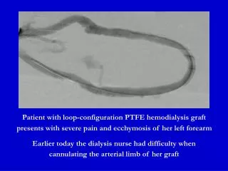 Patient with loop-configuration PTFE hemodialysis graft presents with severe pain and ecchymosis of her left forearm