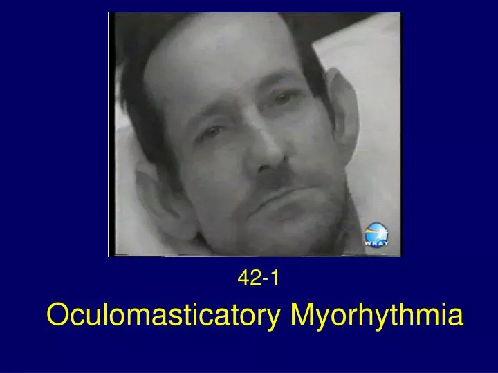 oculomasticatory myorhythmia