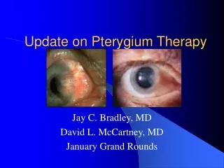 Update on Pterygium Therapy