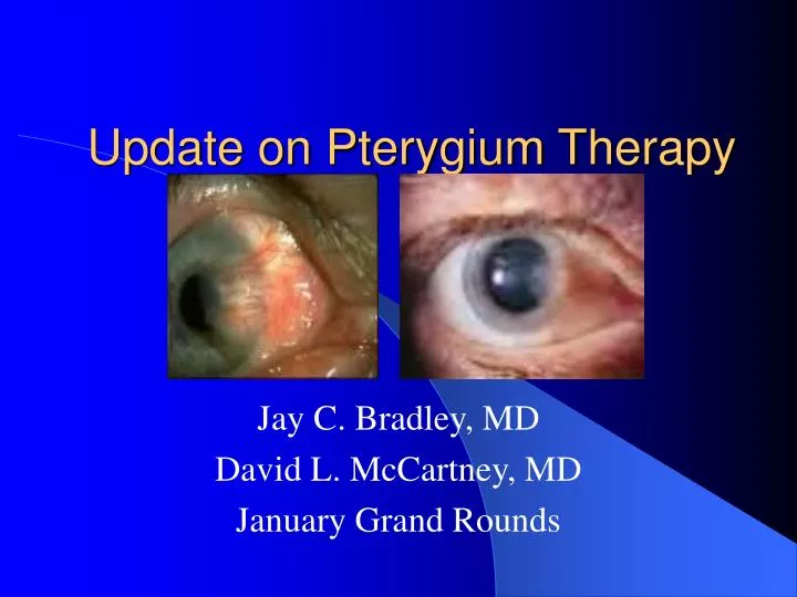 update on pterygium therapy