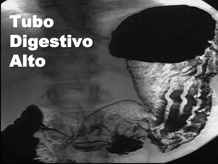 tubo digestivo alto