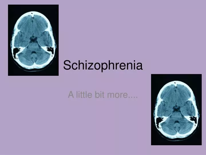 schizophrenia