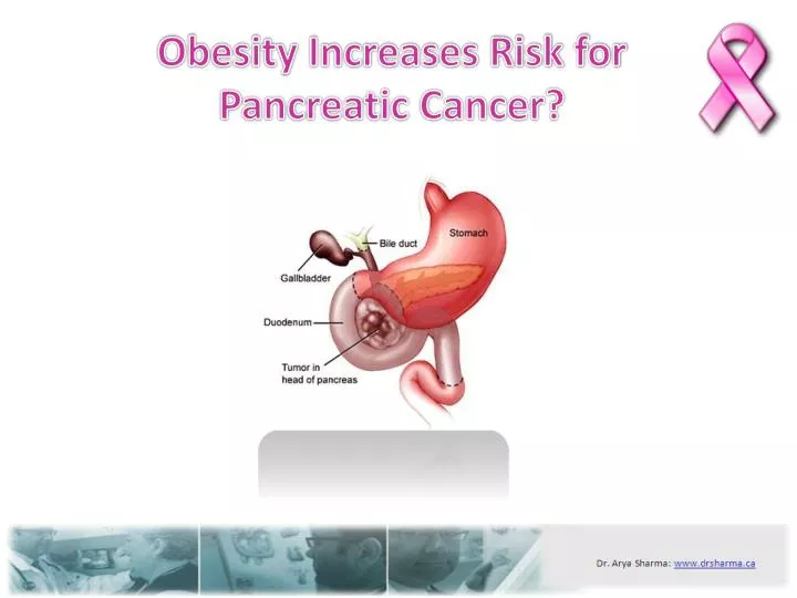 obesity increases risk for pancreatic cancer