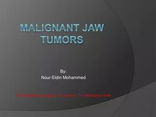 Malignant Jaw tumors