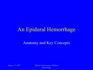 An Epidural Hemorrhage