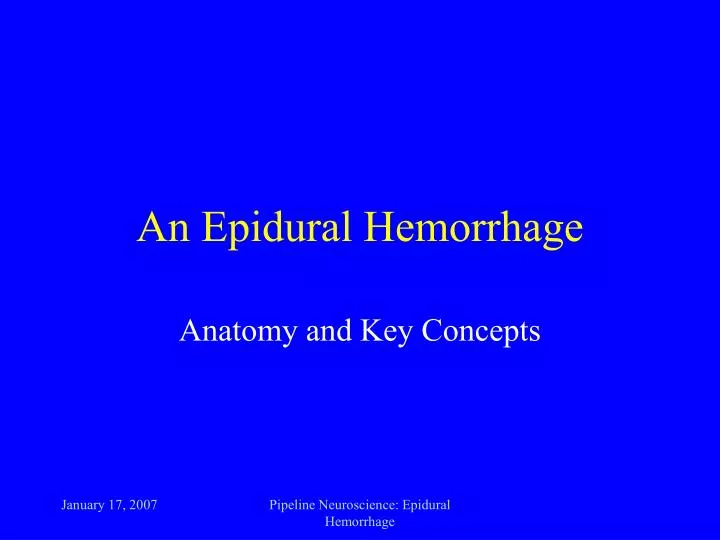 an epidural hemorrhage
