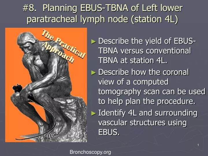 8 planning ebus tbna of left lower paratracheal lymph node station 4l