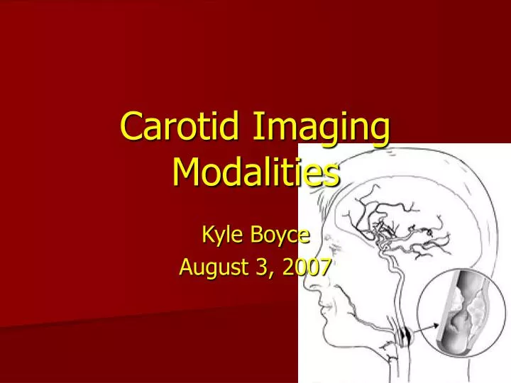 carotid imaging modalities
