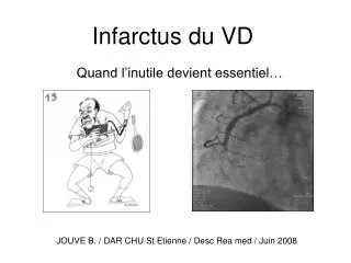 infarctus du vd