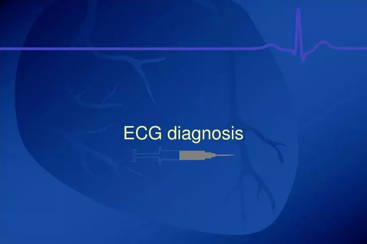 ecg diagnosis