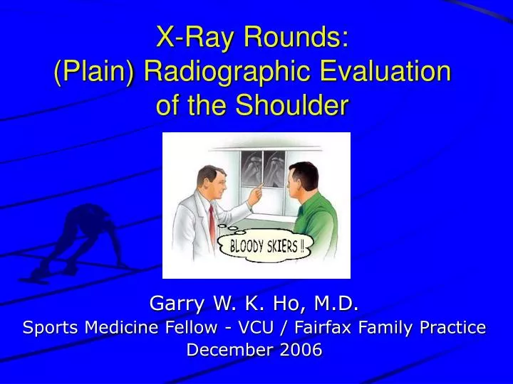 x ray rounds plain radiographic evaluation of the shoulder