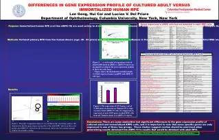 DIFFERENCES IN GENE EXPRESSION PROFILE OF CULTURED ADULT VERSUS IMMORTALIZED HUMAN RPE Lee Geng, Hui Cai and Lucian V. D