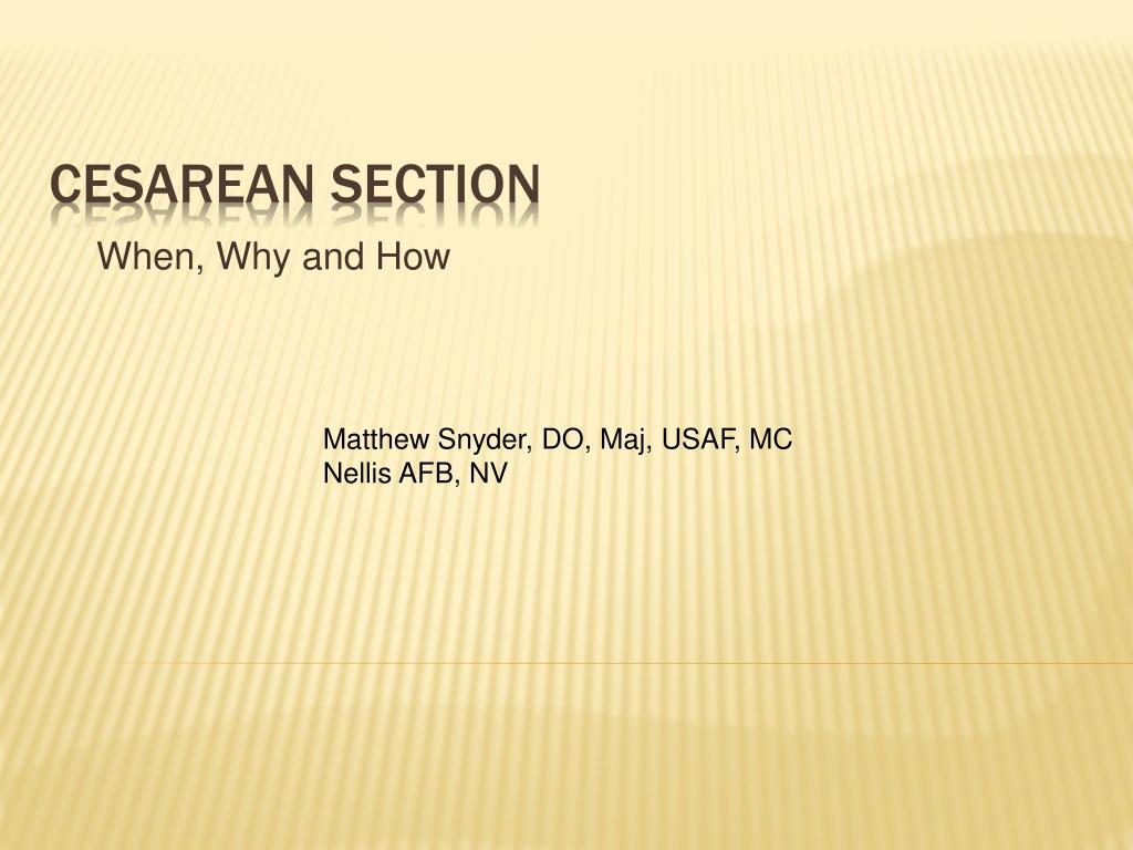 PPT - Cesarean Section PowerPoint Presentation, free download - ID:1236509