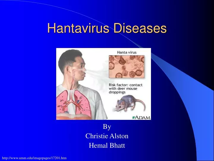 hantavirus diseases