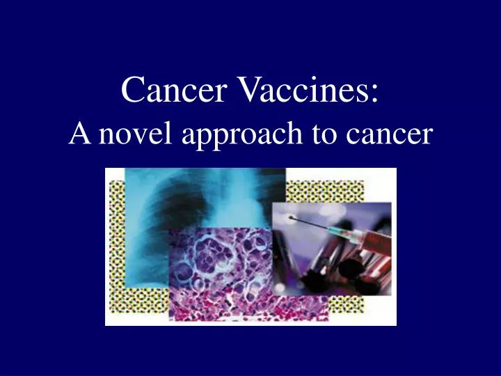 cancer vaccines a novel approach to cancer
