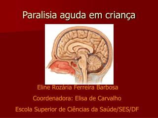 paralisia aguda em crian a