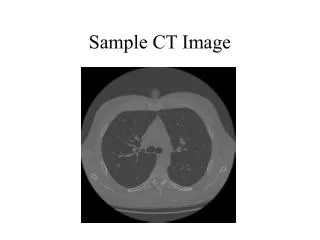 Sample CT Image