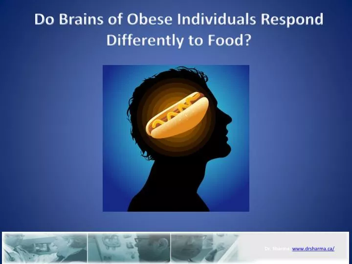 do brains of obese individuals respond differently to food