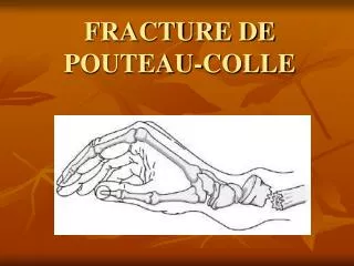 fracture de pouteau colle