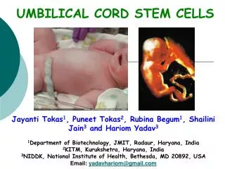 UMBILICAL CORD STEM CELLS