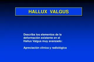 hallux valgus