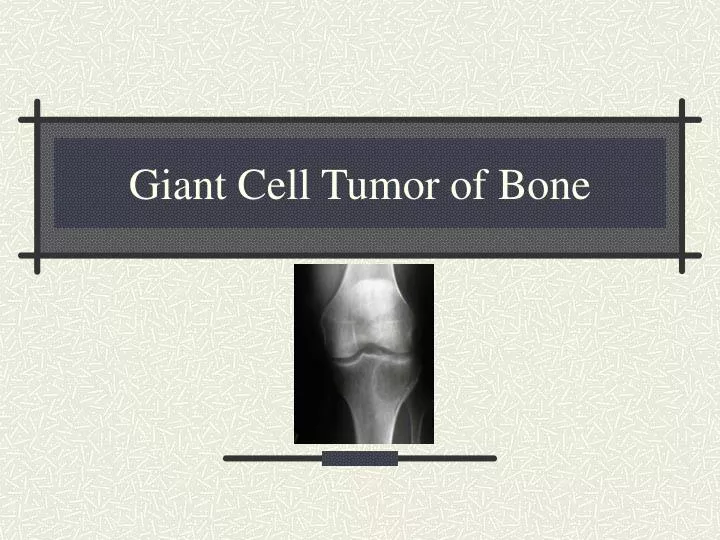 giant cell tumor of bone