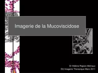 dr h l ne ropion michaux du imagerie thoracique mars 2011