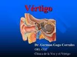 Vértigo - slide 1